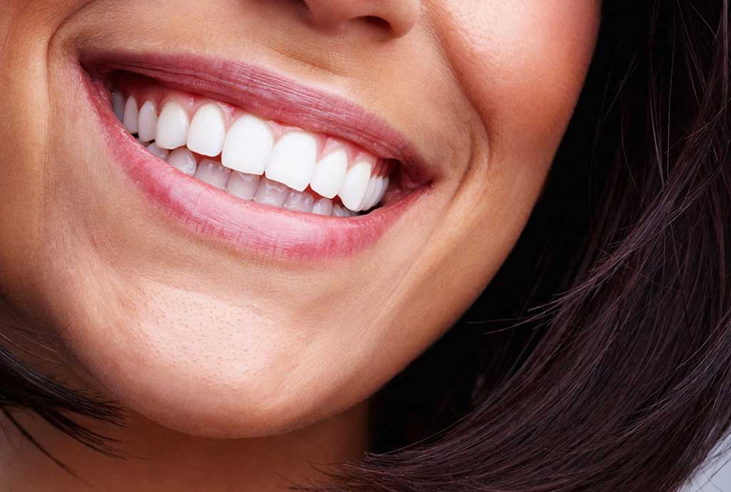 Cosmetic Dentistry